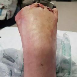 脚趾网红,走红网络的新奇现象解析